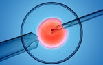 Sinh con bằng phương pháp IVF như Minh Hằng thì con có thông minh hơn không?