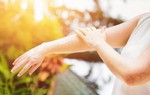 Người bị viêm da cơ địa cần tránh 5 điều này khi nắng nóng để bệnh không bùng phát