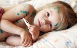 Chăm sóc trẻ bị thủy đậu: Tuyệt đối không được làm vỡ mụn nước!