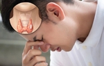 Tưởng đau đầu do mất ngủ, ai ngờ mắc ung thư tuyến giáp
