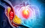 Sắp có thuốc làm giảm 60% mức cholesterol “xấu” trong 8 tuần