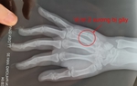 Hà Nội: Công an điều tra vụ người phụ nữ bị đánh sảy thai khi đi ăn tối