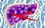 Phát hiện loại virus mới gây bệnh viêm gan ở một bệnh nhân nữ