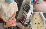 Dịch vụ bắt "sâu mắt", "sán mắt" tại các spa khiến nhiều chị em hứng thú, chuyên gia cảnh báo 3 sự thật