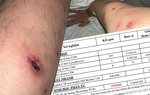 Chàng trai 24 tuổi nhiễm HIV giai đoạn cuối quyết tâm làm lại cuộc sống 