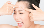 11 nguyên nhân gây mụn trứng cá, số 10 rất nhiều người mắc phải