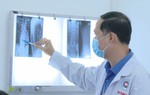 Tổn thương đốt sống, gãy xương sườn sau khi nắn bẻ khớp