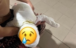 Xót xa bé trai 6 tháng tuổi bị bỏng nặng, đi chữa trị trong túi vỏn vẹn 3 triệu đồng