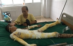 Mẹ khóc ngất cầu cứu vì con trai bị điện giật bỏng nặng không tiền cứu chữa