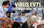 Virus gây bệnh tay chân miệng đã trở lại: EV71 nguy hiểm thế nào?