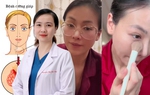 Bệnh cường giáp của hoa hậu Phương Khánh có gây ra nhiều biến chứng nguy hiểm?