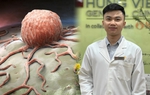 "Bị ung thư có nên đụng dao kéo" qua cách lý giải của bác sĩ 
