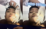 Bé trai 11 tuổi mọc răng thừa ngay giữa 2 răng cửa