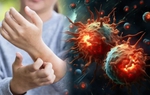 80% bệnh nhân ung thư tuyến tụy có chung "1 triệu chứng không ngờ tới"