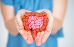 Khi bị polyp đại tràng sẽ có 3 dấu hiệu bất thường, bạn cần đi kiểm tra càng sớm càng tốt