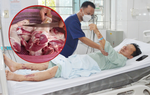 Người đàn ông suy đa tạng nguy kịch sau 3 ngày ăn thịt lợn tự chế biến tại nhà