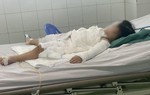 Bé 2 tuổi bị bỏng nặng do uống nước tẩy bồn cầu 