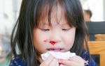 Bé trai 3 tuổi nguy kịch do bà nội xử lý chảy máu cam sai cách