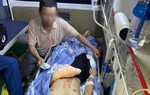 Nam sinh lớp 12 gần đứt lìa bàn tay, tổn thương 2 mắt sau tiếng nổ lớn