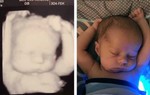 Tư thế ngủ của em bé giống hệt lúc siêu âm gây sốt