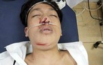 Chồng biệt tích, con trai gặp tai nạn nguy kịch trên đường đi học về, người mẹ khẩn cầu giúp đỡ