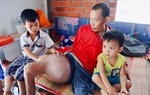 Người cha ung thư xương, ước được sống để nhìn 3 đứa con nhỏ lớn lên
