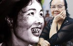 Cuộc đời của "Thị Nở" xấu và kinh điển nhất màn ảnh Việt giờ ra sao?