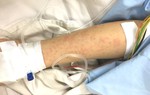Cấp cứu thành công người phụ nữ bị sốc phản vệ sau tiêm vaccine 
