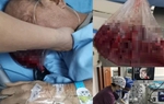 Người đàn ông nôn ra hơn 2 lít máu trong 5 phút vì dạ dày bị “tàn phá” bởi thói quen ăn uống
