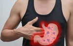 Ung thư dạ dày và loét dạ dày dễ gây nhầm lẫn: Làm thế nào để phân biệt?