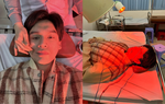 Nam ca sĩ liệt nửa mặt ngay trong buổi biểu diễn: Đâu là nguyên nhân?