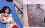 Từ vụ bé gái bị chó cắn trọng thương ở Hà Giang: Những mối nguy hiểm nào nếu mắc bệnh dại?