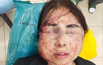Người phụ nữ bị chồng bạo hành trước ngày ly hôn:
Chồng tôi mắc "bệnh" cuồng ghen