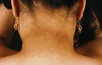 1 trong 4 bộ phận cơ thể chuyển sang màu đen có thể cảnh báo sức khoẻ đang gặp vấn đề
