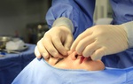 TPHCM: Liên tiếp sự cố y khoa thẩm mỹ, 1 phụ nữ tử vong