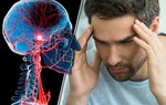 Đột quỵ có di truyền không?