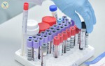 Nhập viện cấp cứu do tự ý chỉnh liều thuốc điều trị viêm gan B