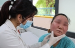 Gặp biến chứng nặng khi tự "peel" da tại nhà
