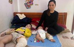 Xót xa 2 đứa trẻ vừa chào đời đã gãy cả 2 chân, không tiền chữa trị