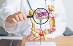 Phát triển máy in sinh học siêu nhỏ có thể chữa lành loét dạ dày