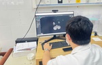 Thiếu niên 15 tuổi tổn thương não vì ngộ độc thuốc lá điện tử chứa chất độc thế hệ mới