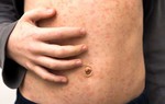 Số ca sởi gia tăng, thận trọng với dấu hiệu bệnh sởi chuyển nặng