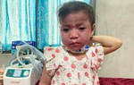 Mẹ mong níu giữ chút ánh sáng cho con gái 4 tuổi chưa biết nói, chưa biết đi, toàn thân đỏ thẫm vì bệnh quái ác