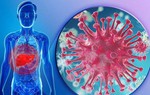Nhiều hy vọng cho bệnh nhân viêm gan virus tại Việt Nam