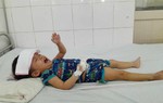 Bé gái 3 tuổi phải trải qua 7 ca phẫu thuật giành lại sự sống