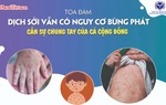 Dịch sởi vẫn có nguy cơ bùng phát, cần sự chung tay của cả cộng đồng
