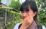 Nữ sinh bị nhóm bạn đánh hội đồng do mâu thuẫn khi chơi cùng nhóm