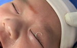 Hi hữu: Mẹ cắt móng tay văng vào mắt con 2 tháng tuổi