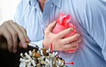 Sử dụng thuốc lá gây ra hơn 100.000 ca tử vong mỗi năm tại Việt Nam