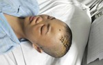 Mẹ suy thận giai đoạn cuối cầu xin sự sống cho con gái nguy kịch vì tai nạn giao thông